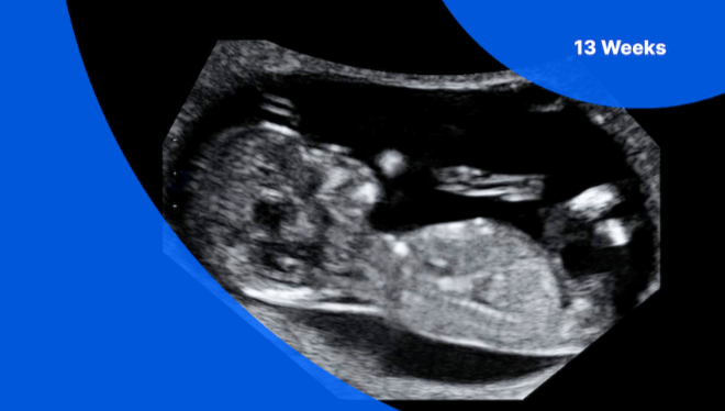 13 Week Baby:-Pm8kgk9pya= Boy Vs Girl Ultrasound 12 Weeks